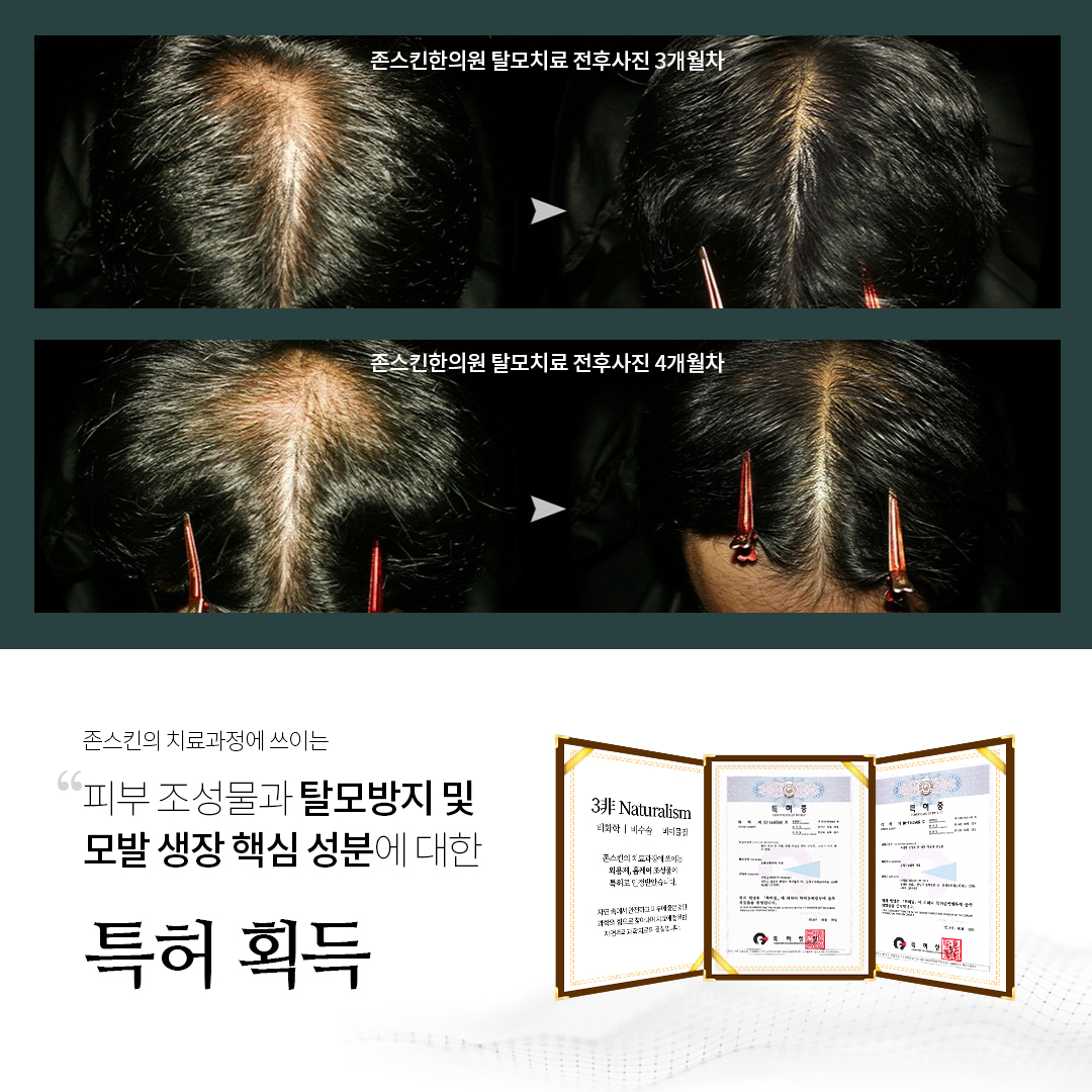 존스킨한의원 잠실점 대표 이미지