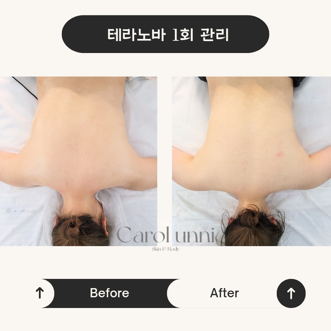 캐롤뷰티 대표 이미지