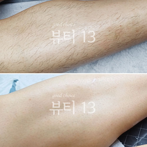 뷰티13