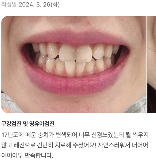 열린오치과의원 대표 이미지