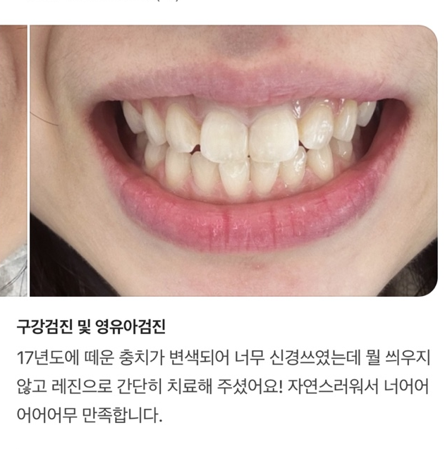 열린오치과의원 대표 이미지