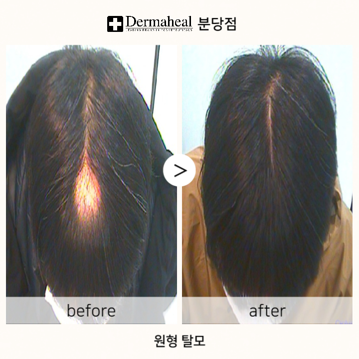 엠지에프두피탈모 센터 이미지