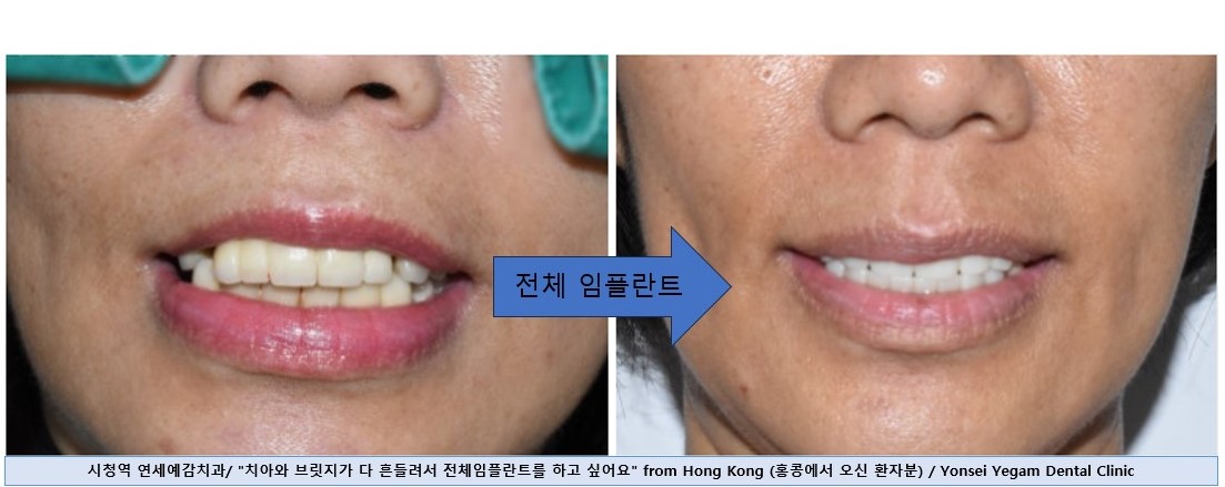 연세예감치과의원 대표 이미지
