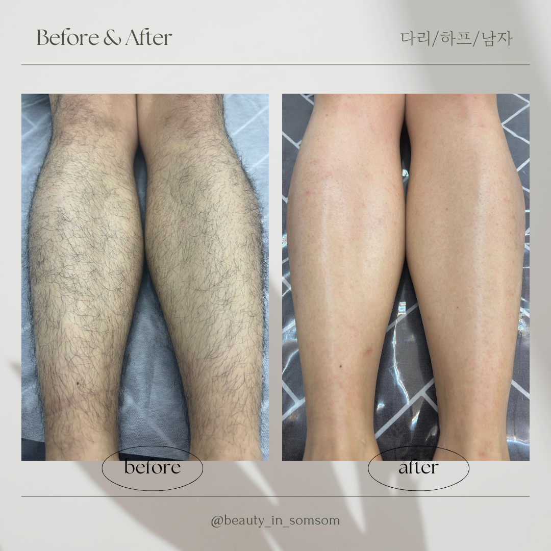 뷰티인솜솜 슈가링 달동점