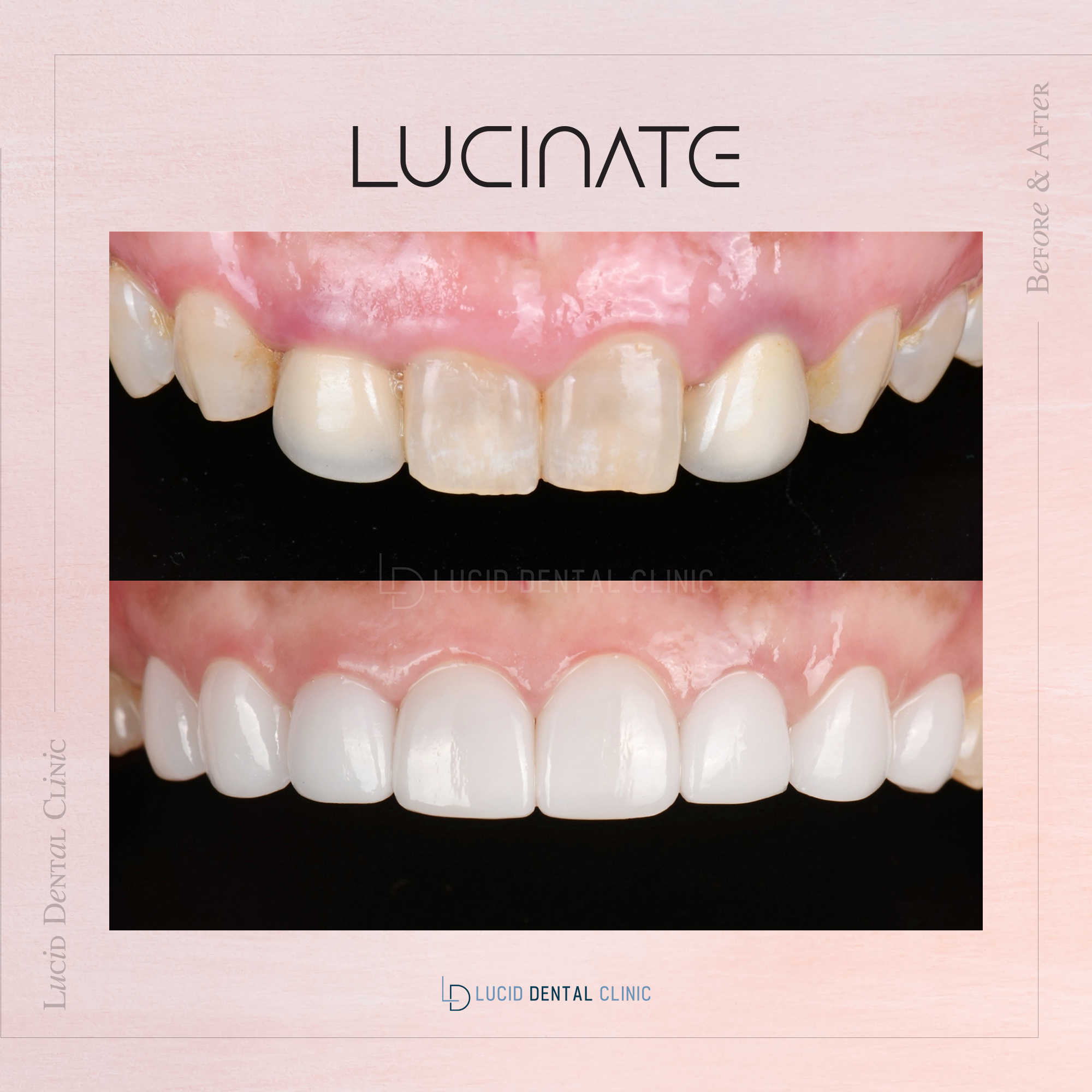 루시드치과의원 대표 이미지