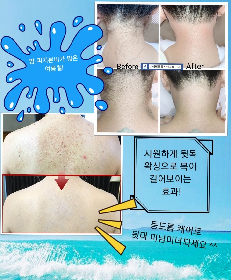 톡톡스킨 대표 이미지