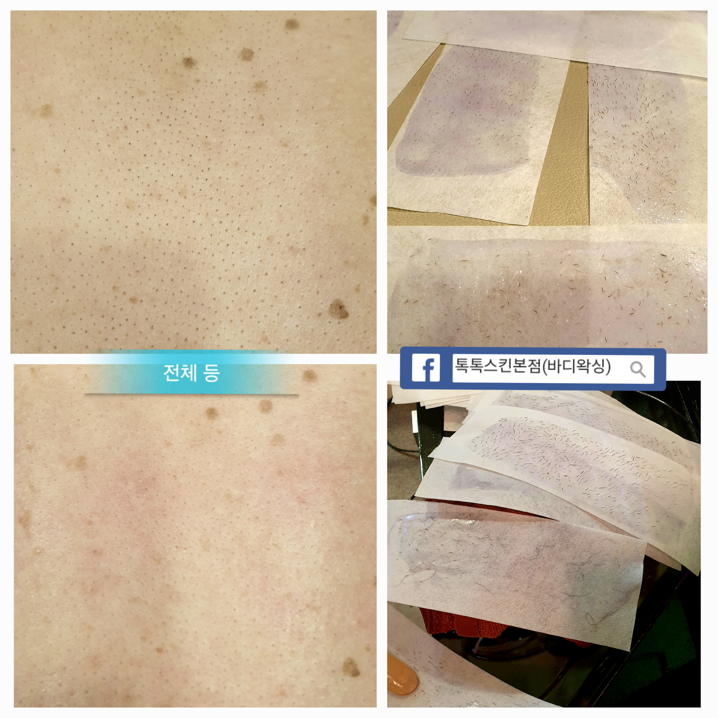 톡톡스킨 대표 이미지