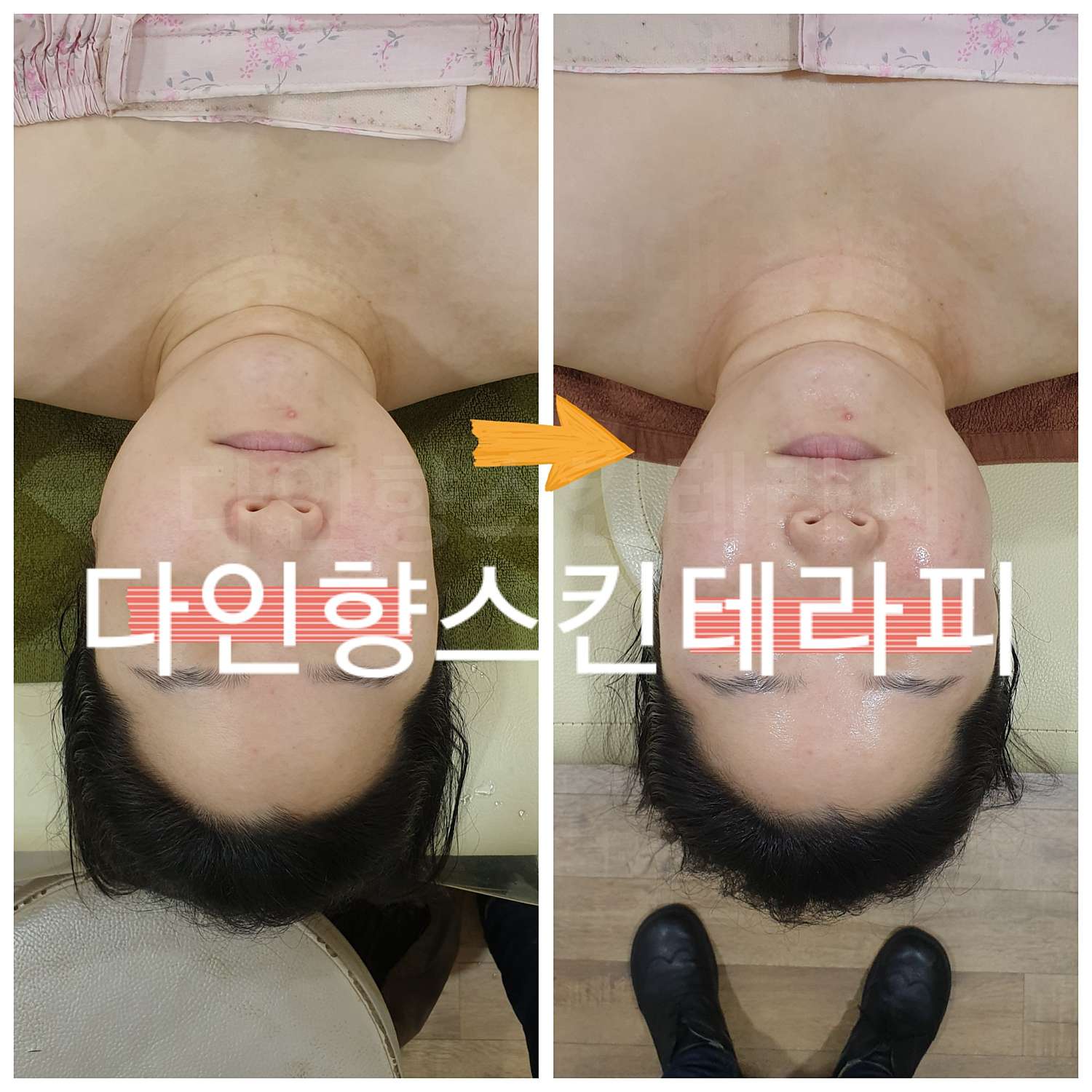 [얼굴,두피,바디] 피부맞춤테라피 이미지