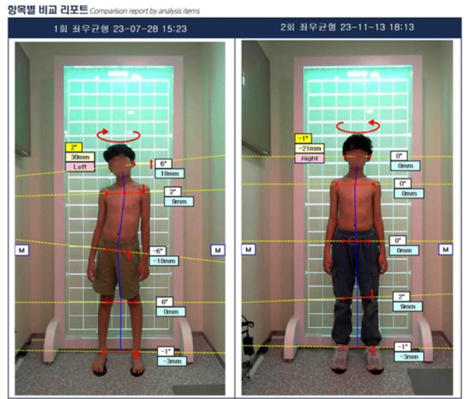 슐레GPG 골프 필라테스 성장체형교정