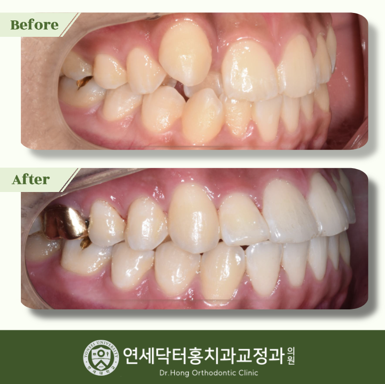 연세닥터홍치과 대표 이미지