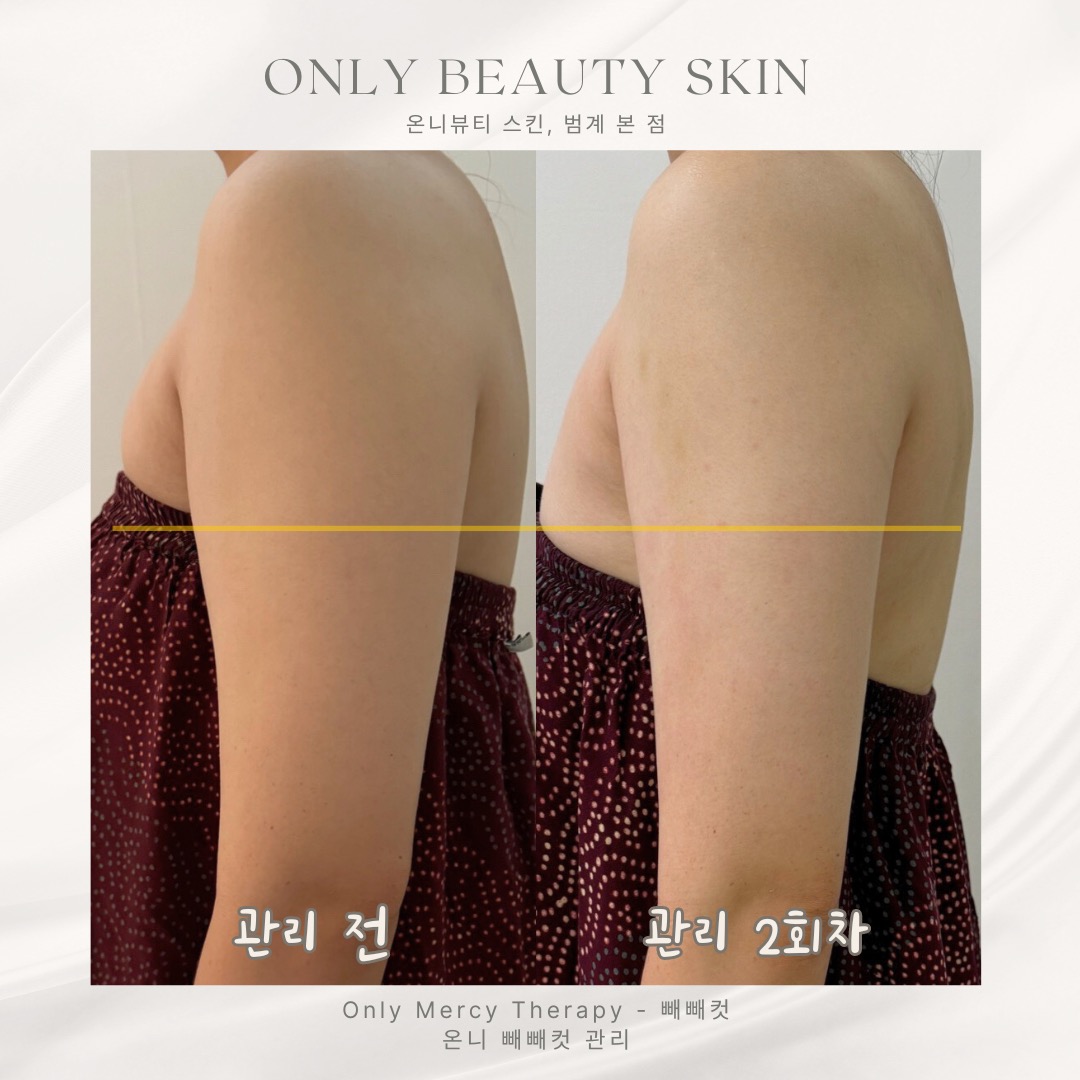 온니뷰티 피부관리&헤드스파 안양범계점