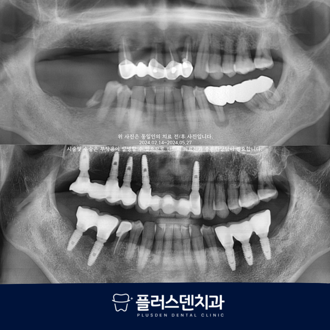 플러스덴치과의원 대표 이미지