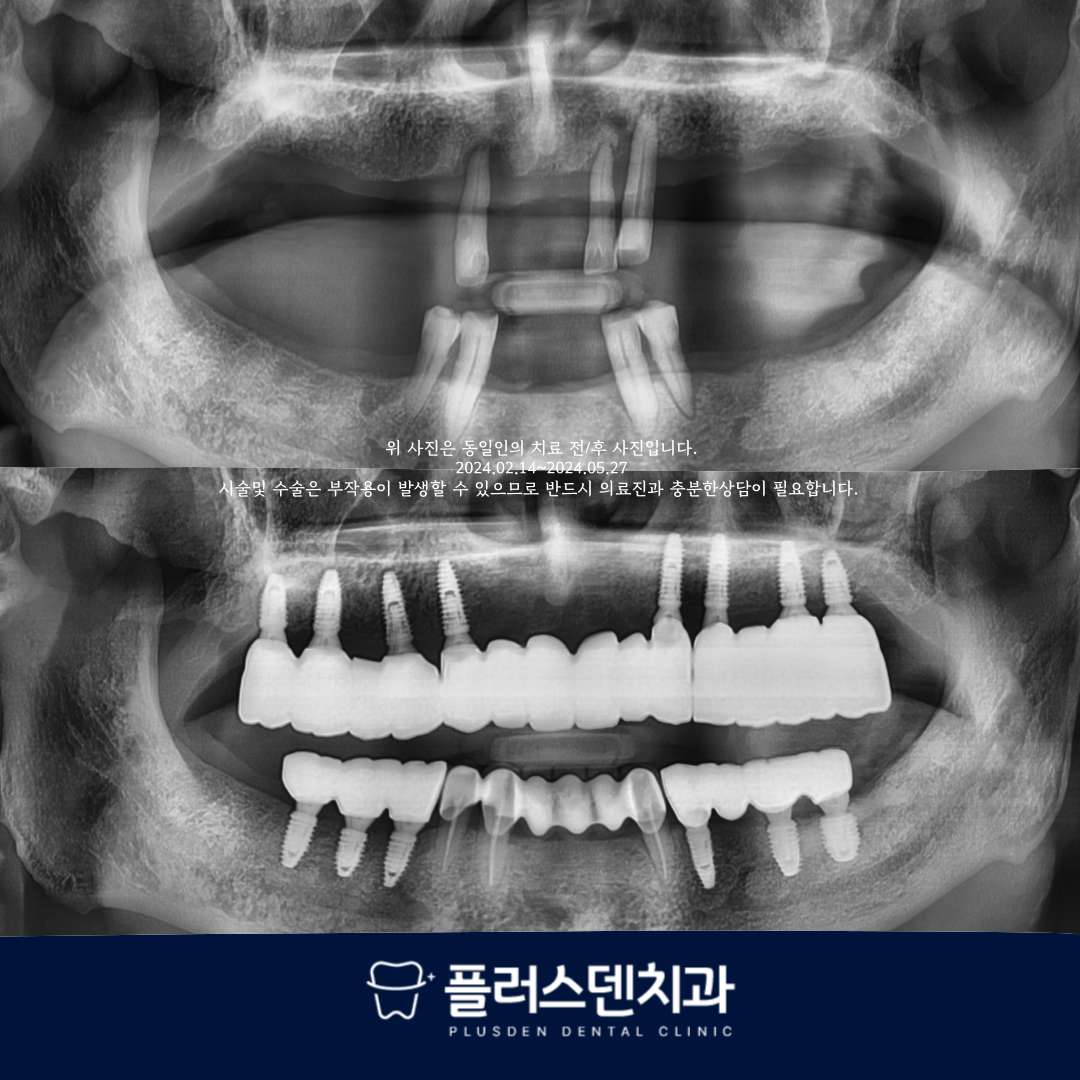 플러스덴치과의원 대표 이미지