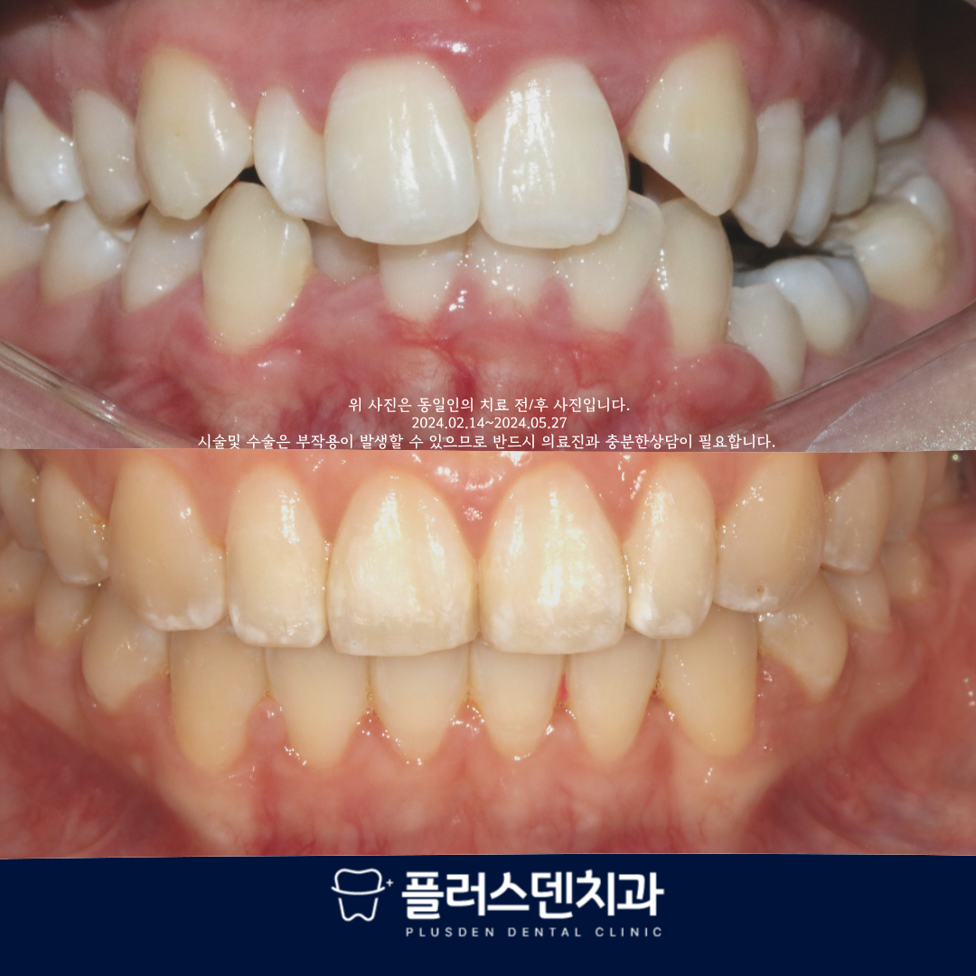 플러스덴치과의원 대표 이미지