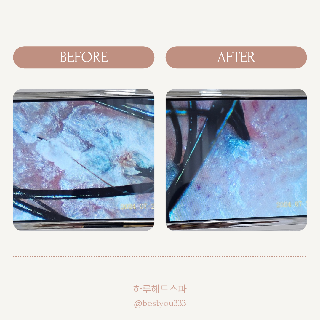 하루헤드스파 대표 이미지