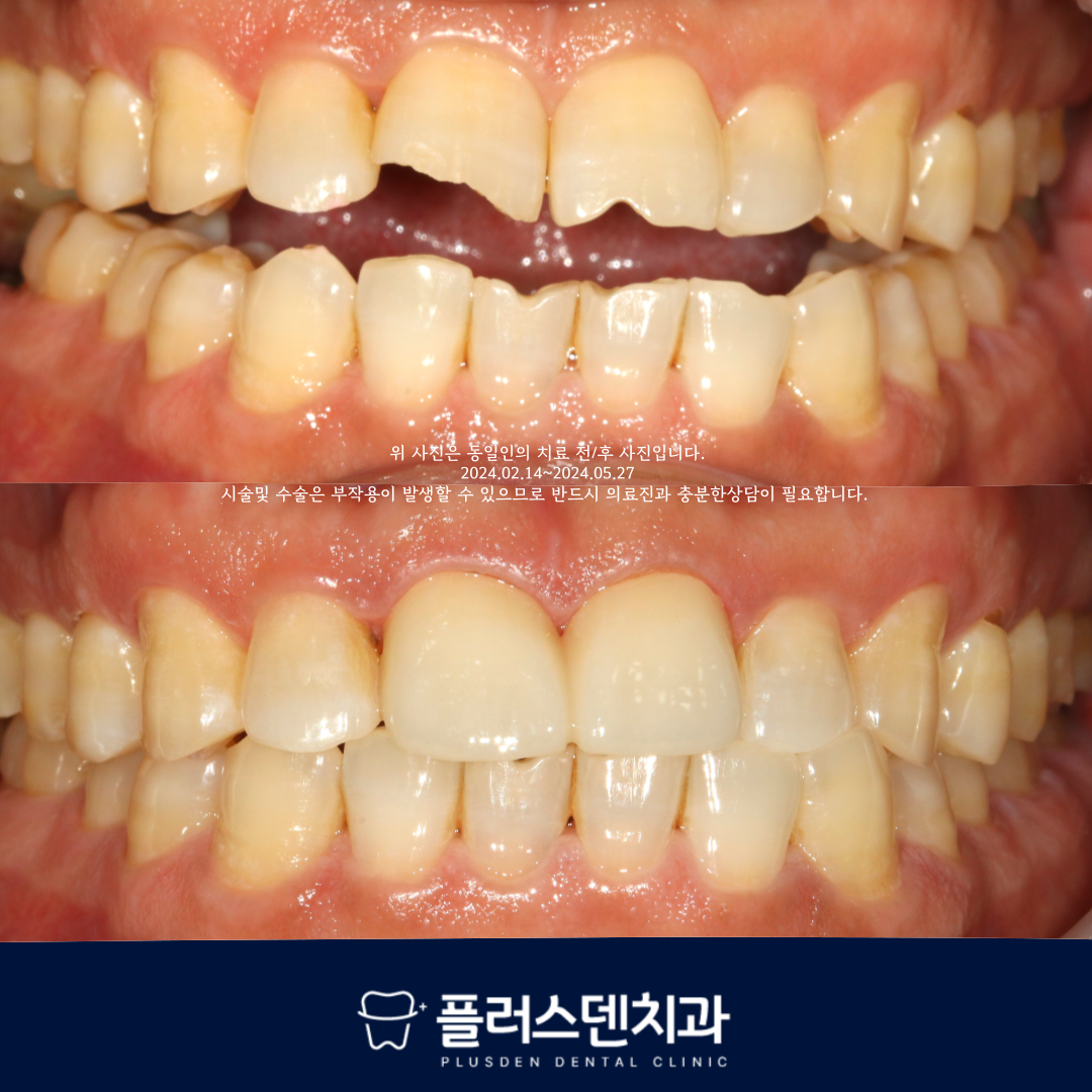 플러스덴치과의원 대표 이미지