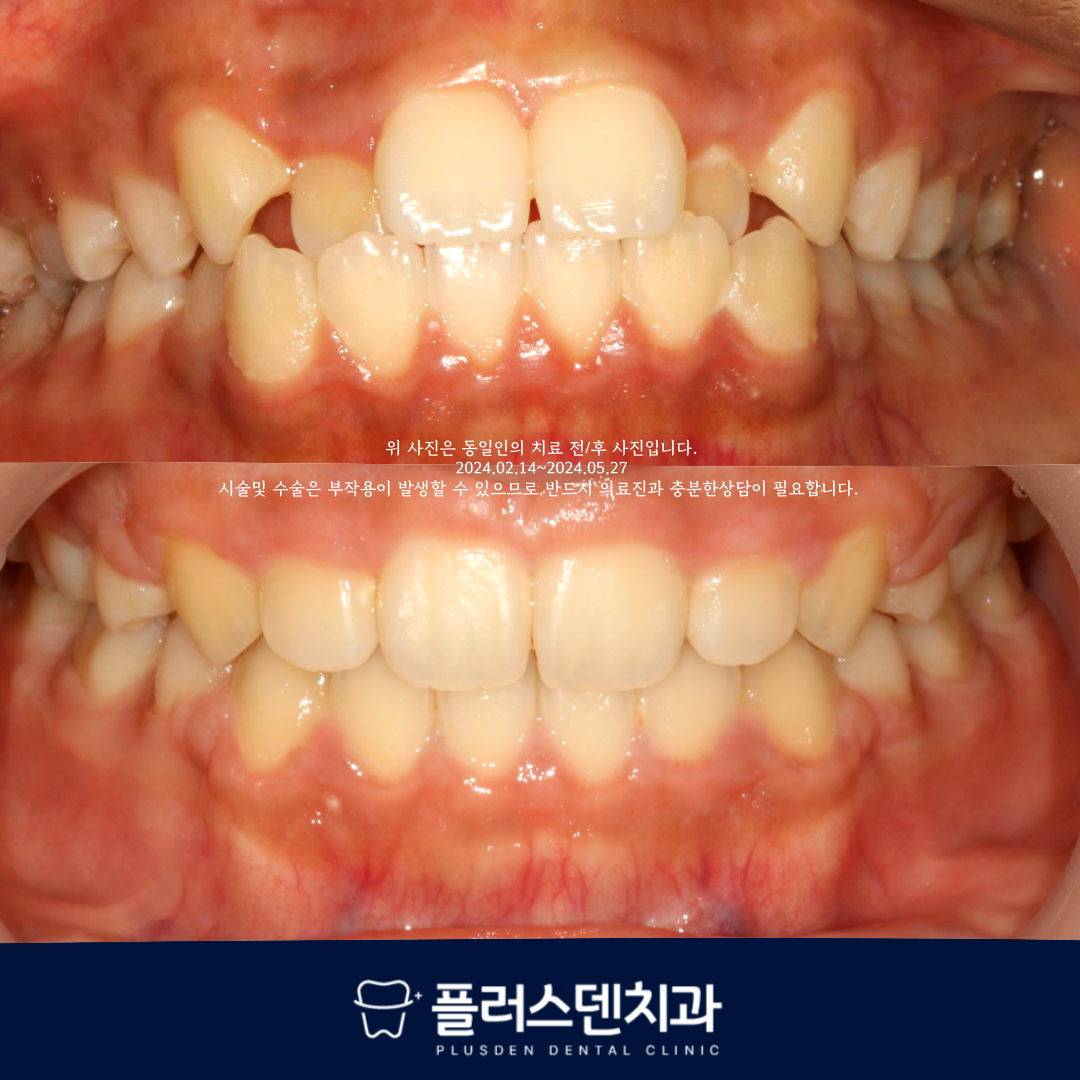 플러스덴치과의원 대표 이미지