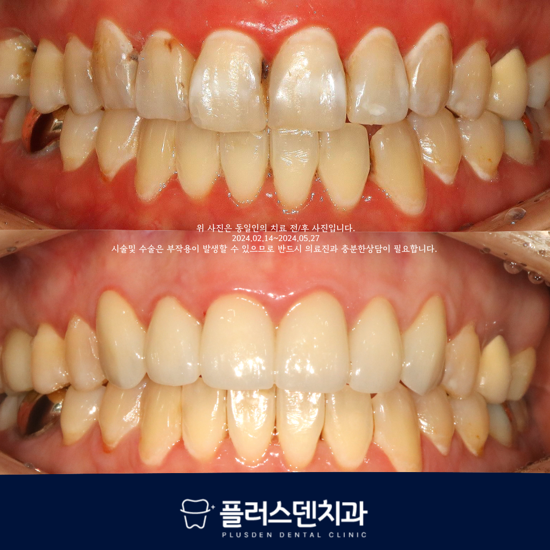 플러스덴치과의원
