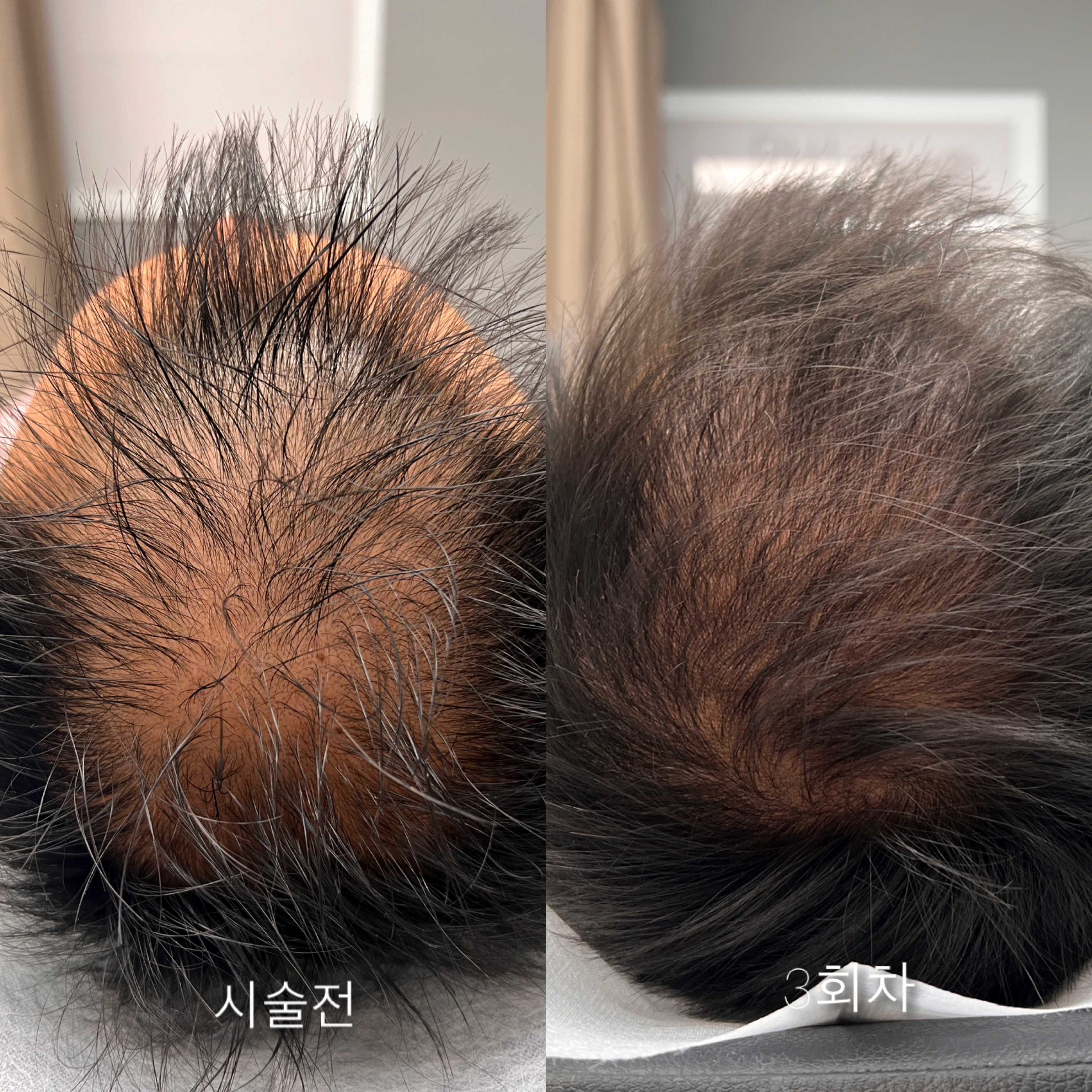 모스테틱 대표 이미지
