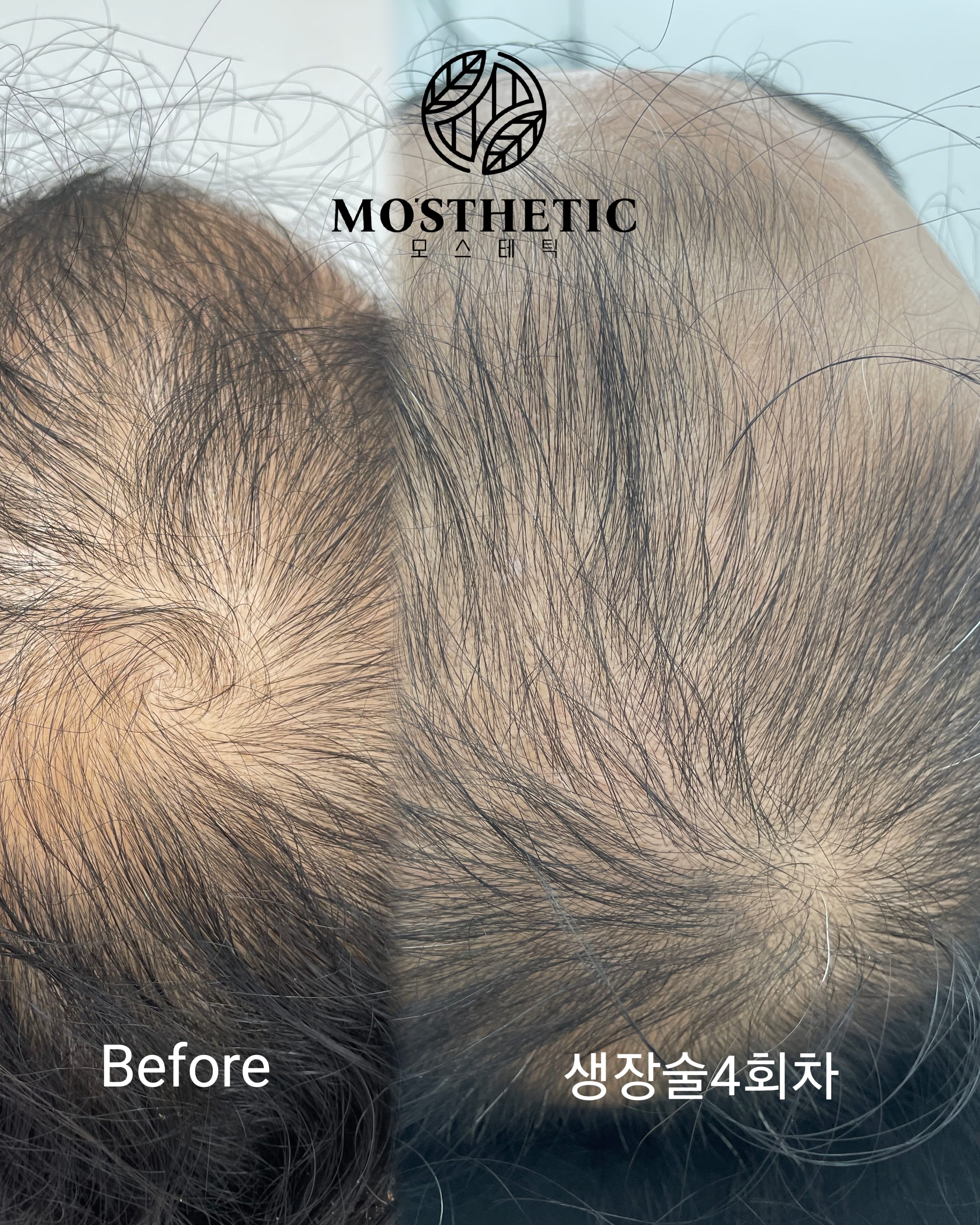 모스테틱 성신여대점 대표 이미지
