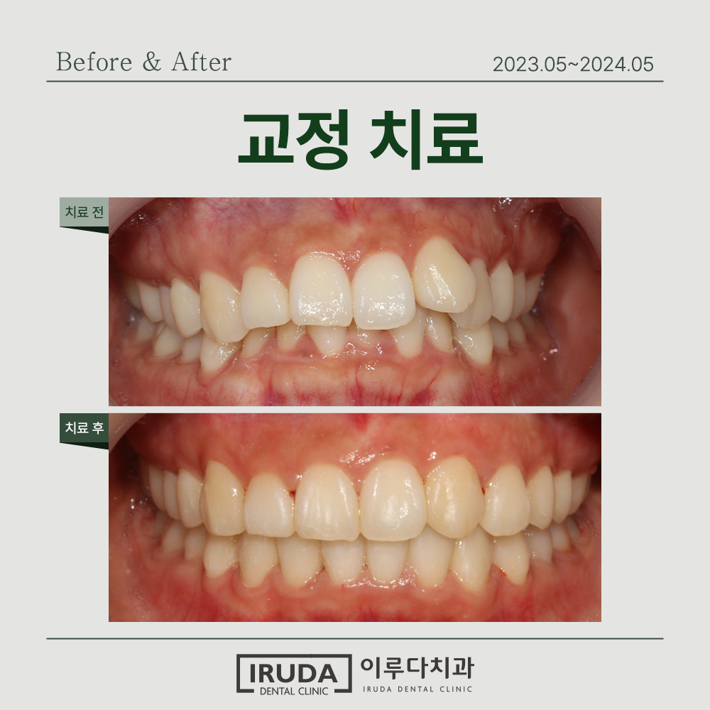 이루다치과의원 부천 대표 이미지