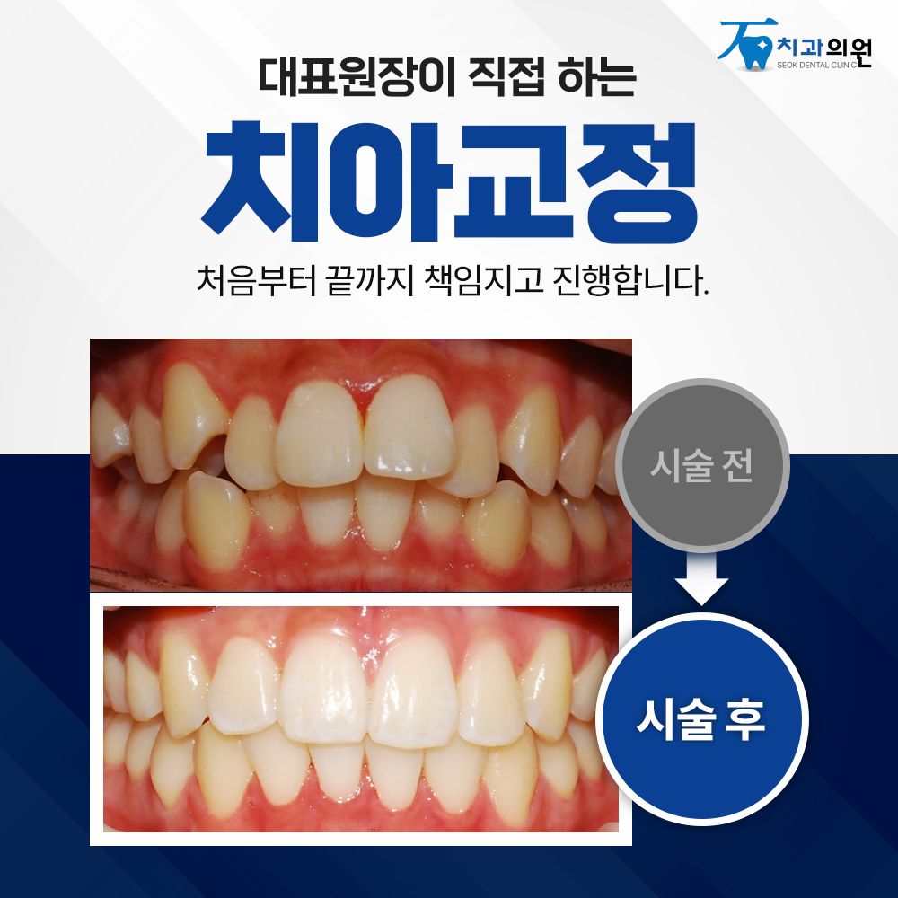 석치과의원 호평동