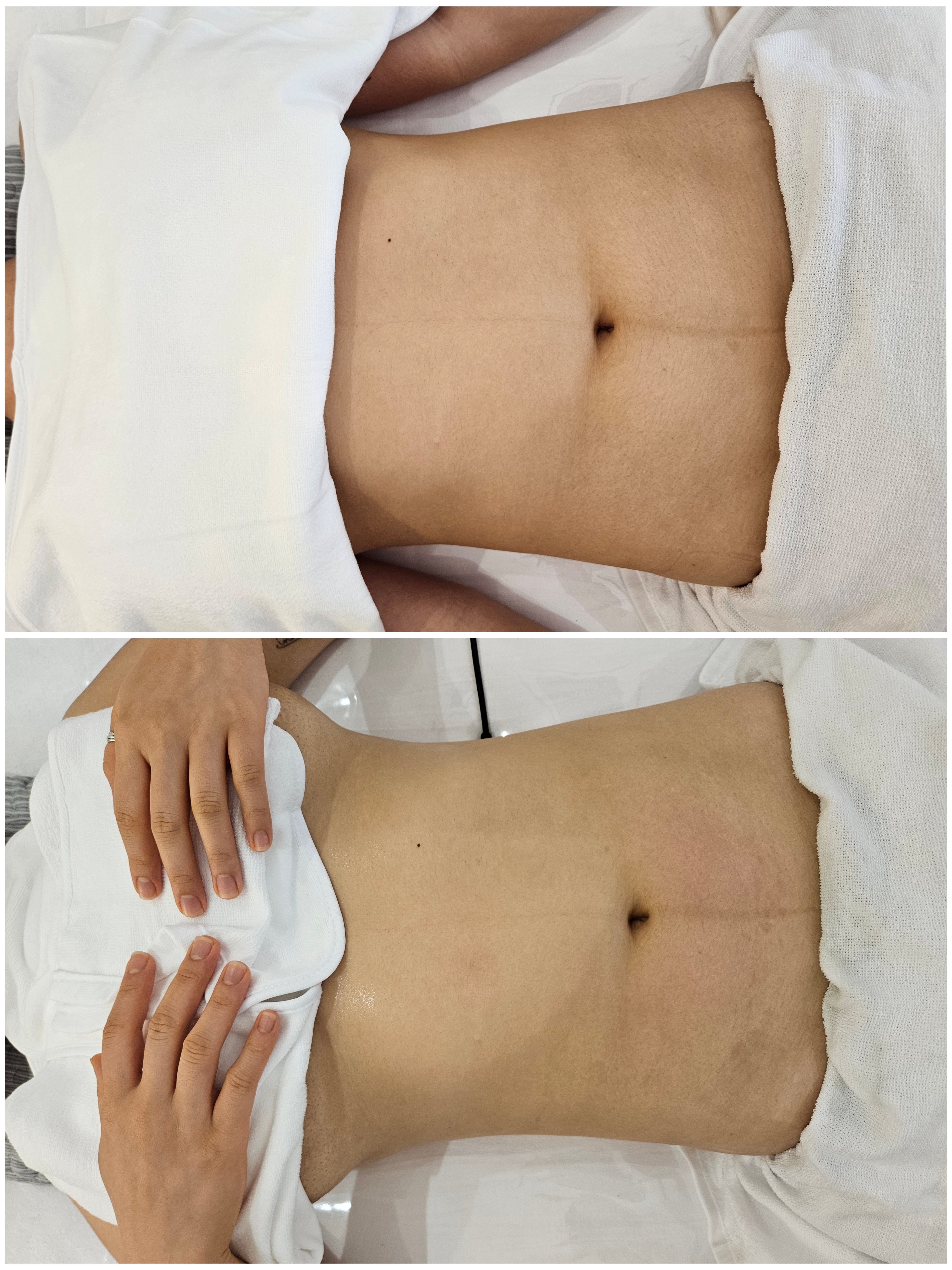 벨보뜨테라피 수유미아본점 photo 10