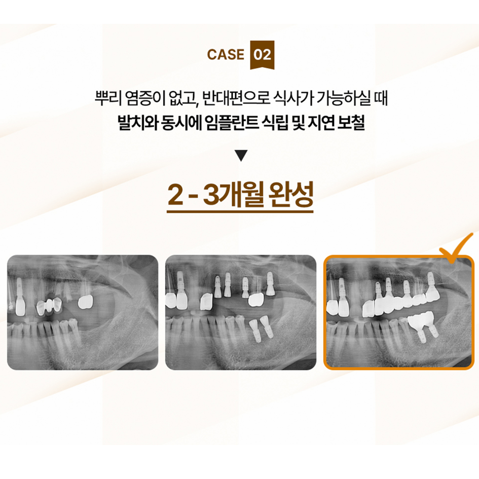 자기치아살리기삼성플란트치과의원 대표 이미지