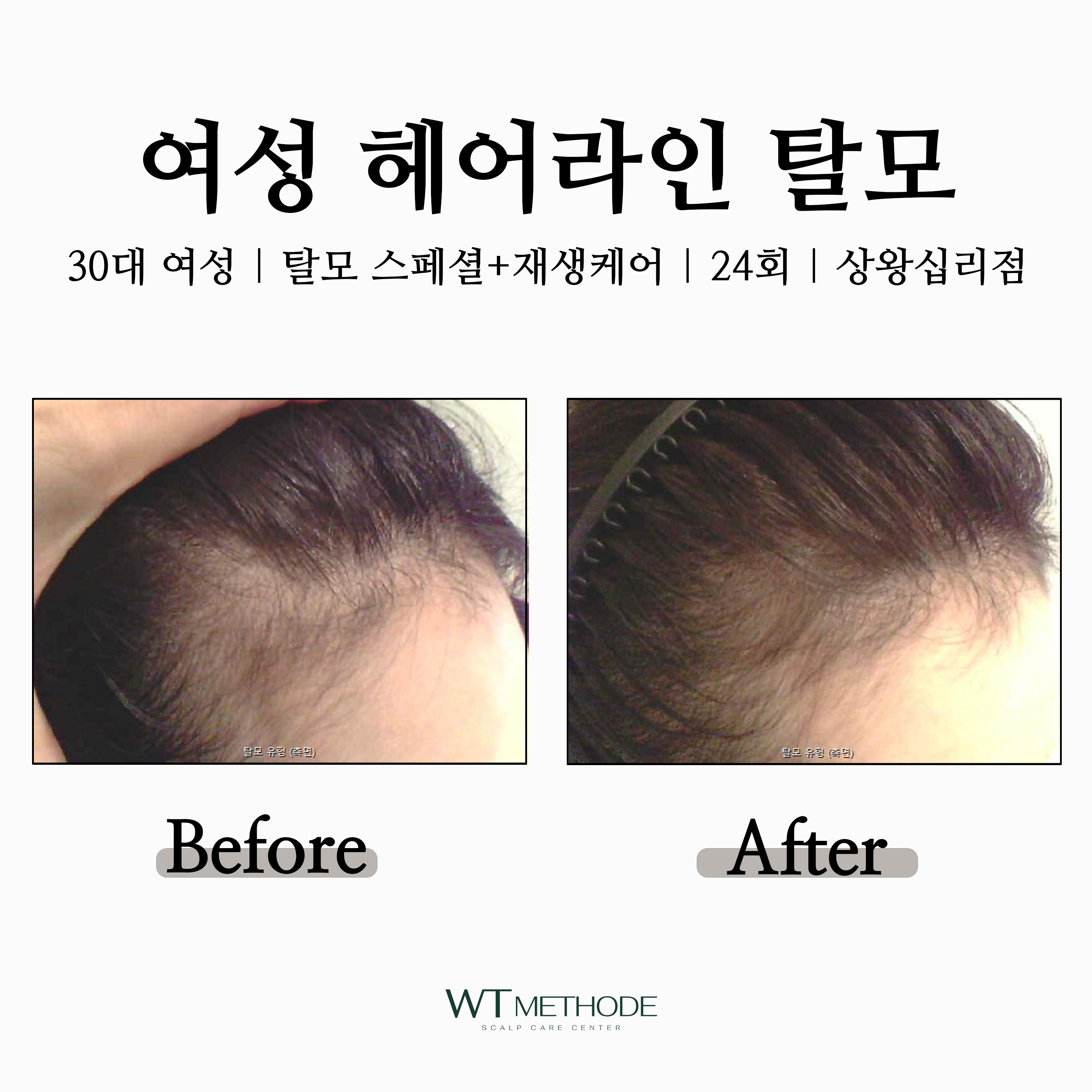 WT메소드 상왕십리점 대표 이미지