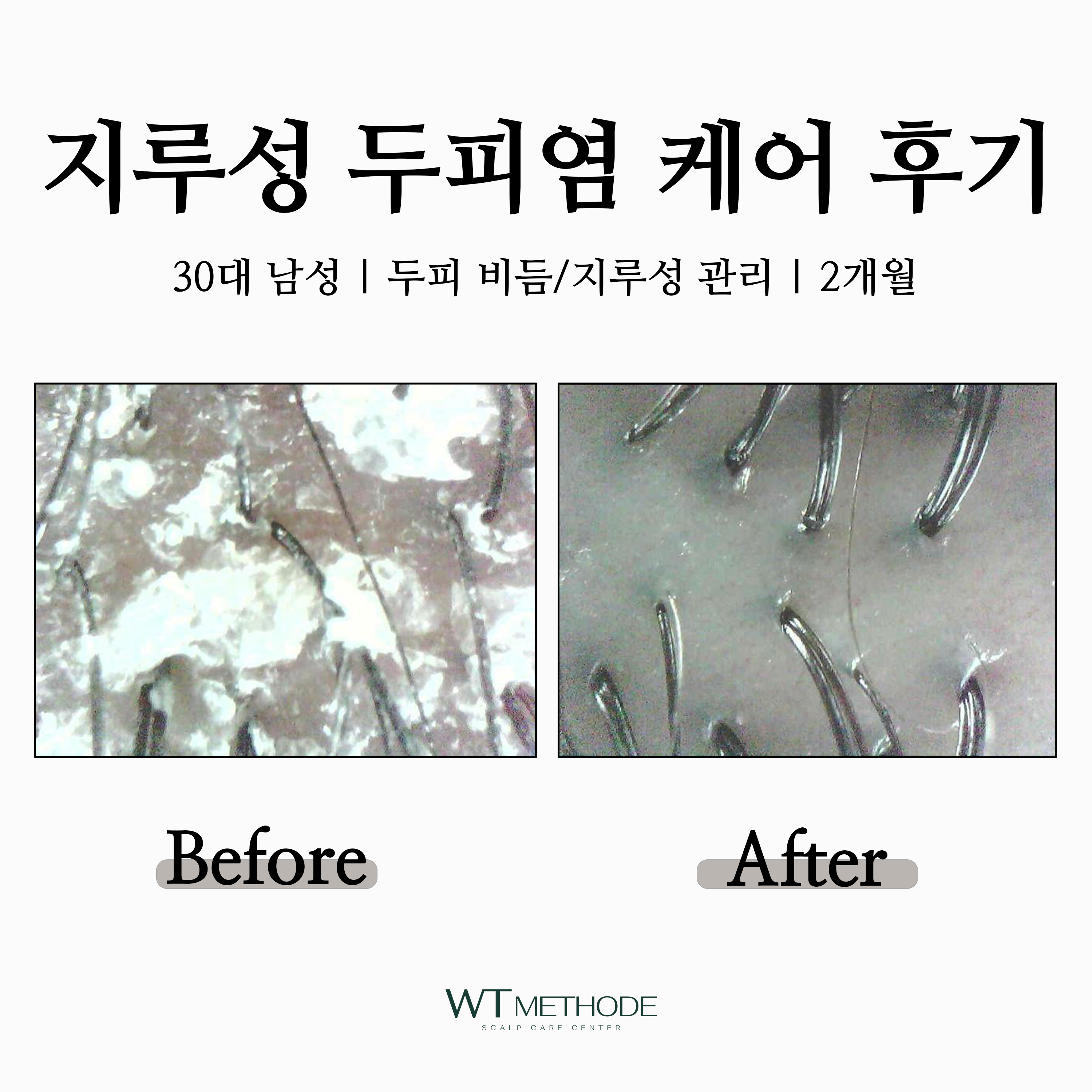 WT메소드 상왕십리점 대표 이미지