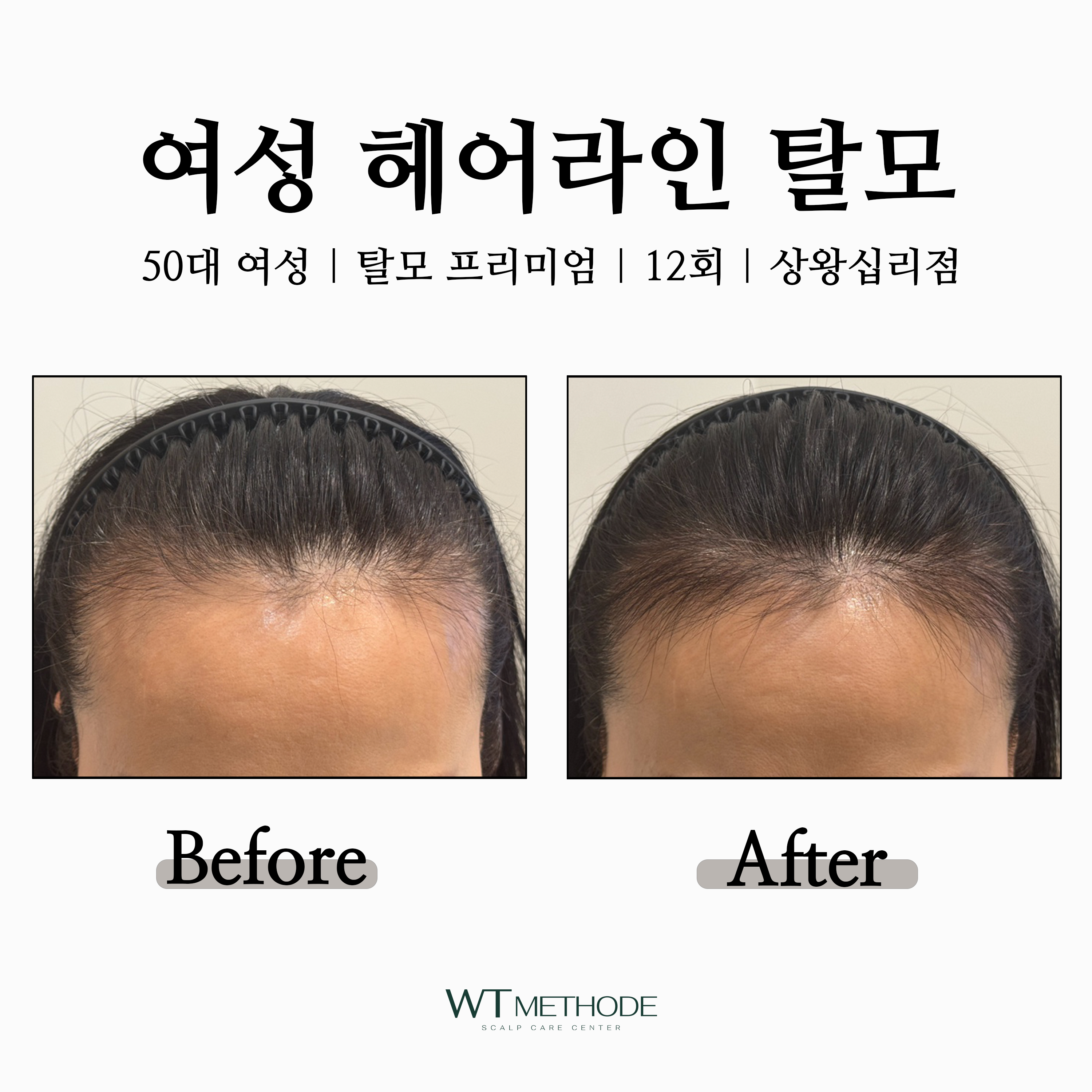 WT메소드 상왕십리점 대표 이미지