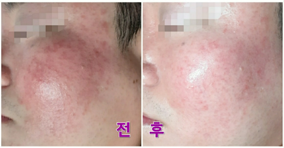 꽃처럼피어날그대 photo 6