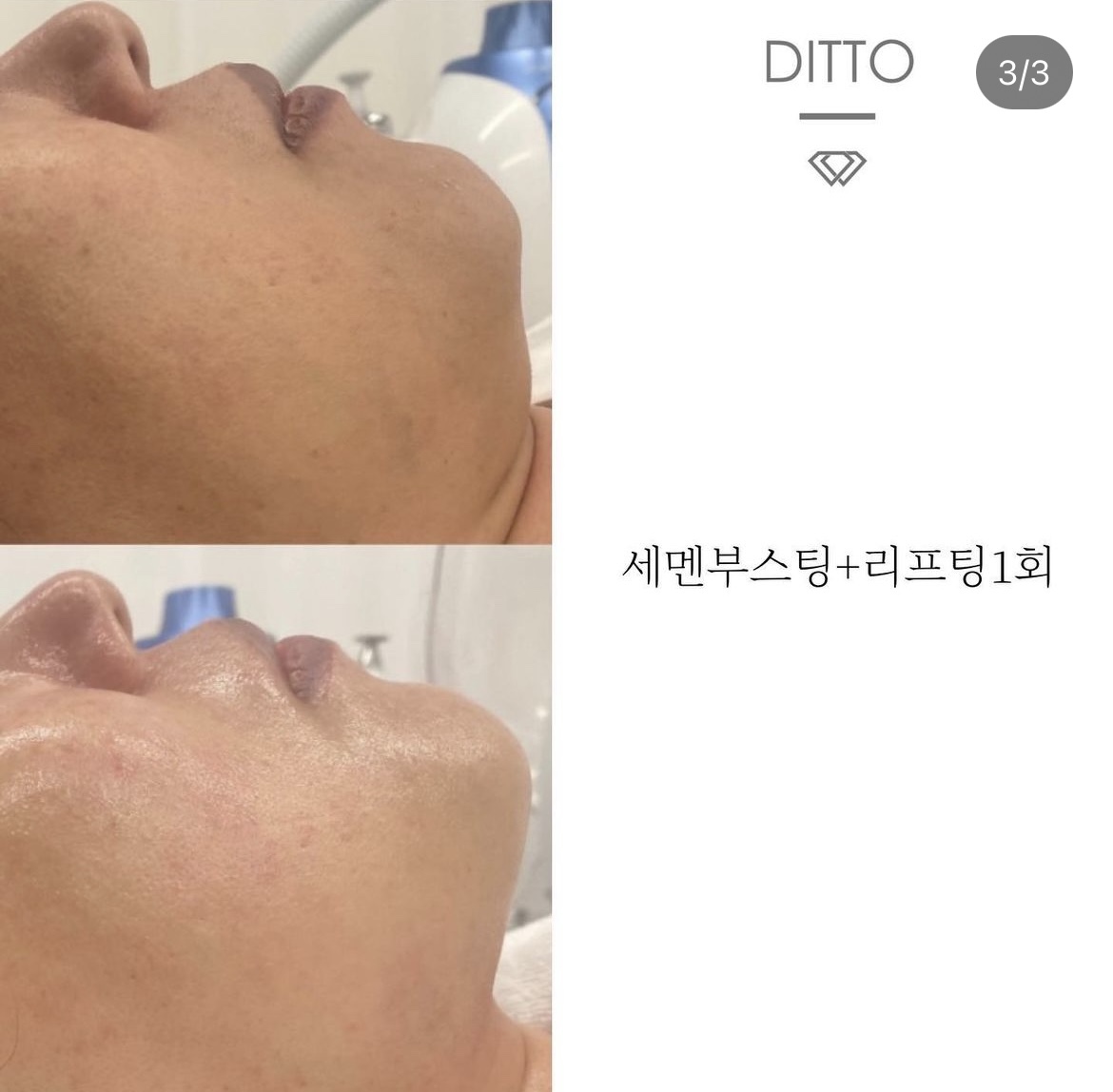 디또뷰티 방배점