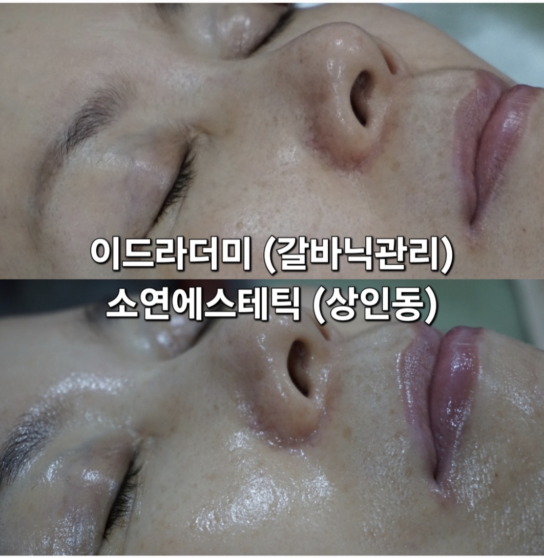 소연에스테틱 상인점