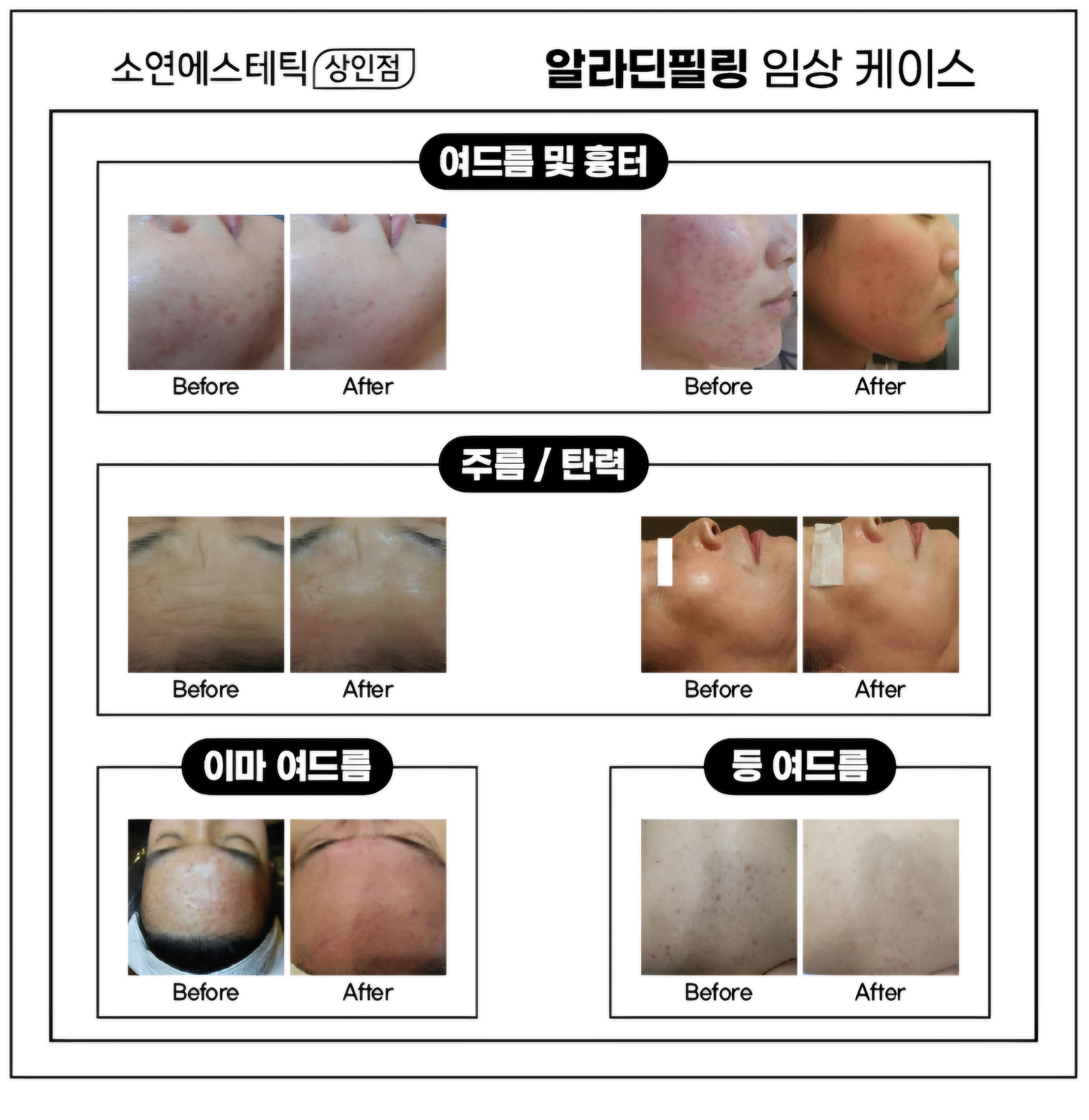 소연에스테틱 상인점