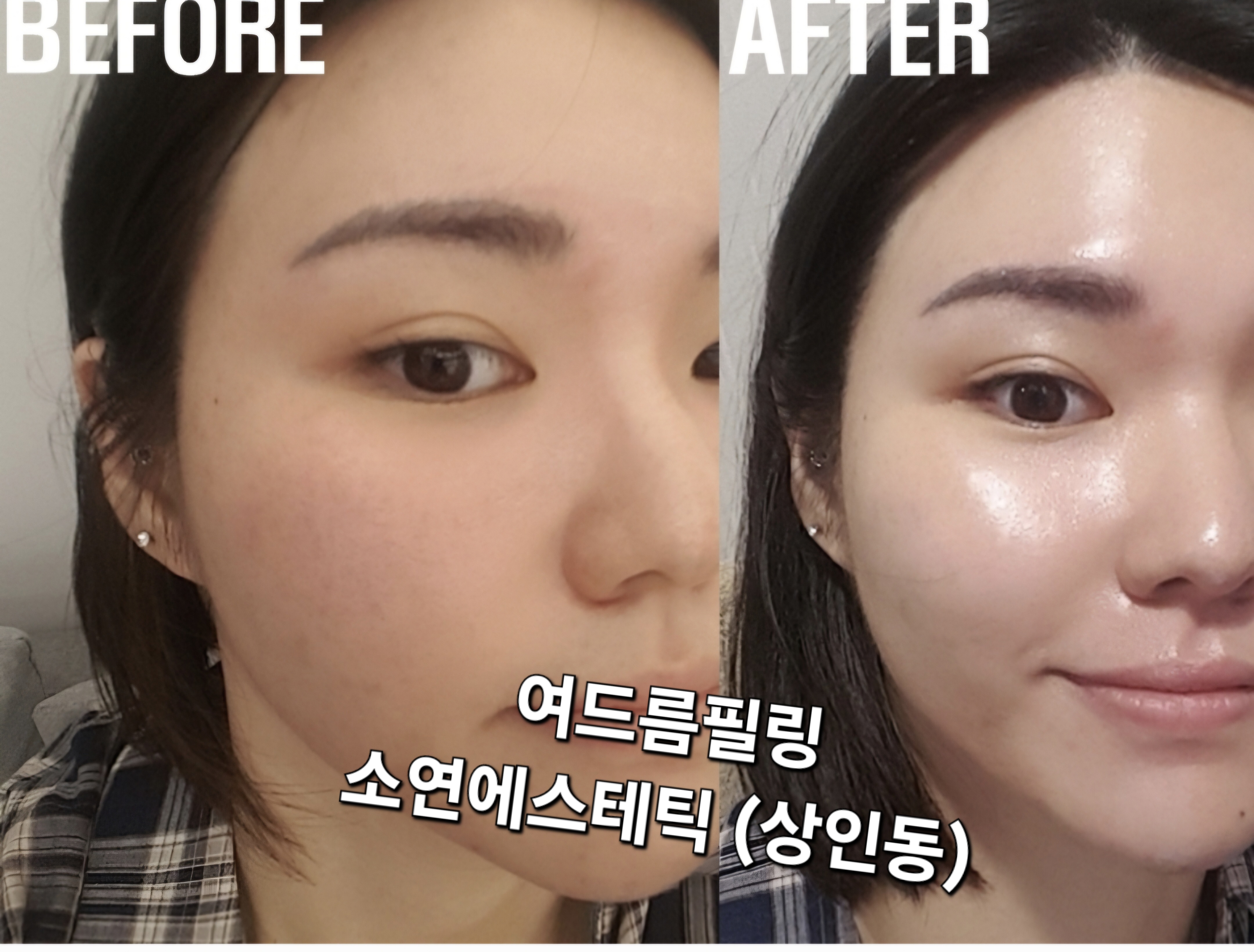 소연에스테틱 상인점
