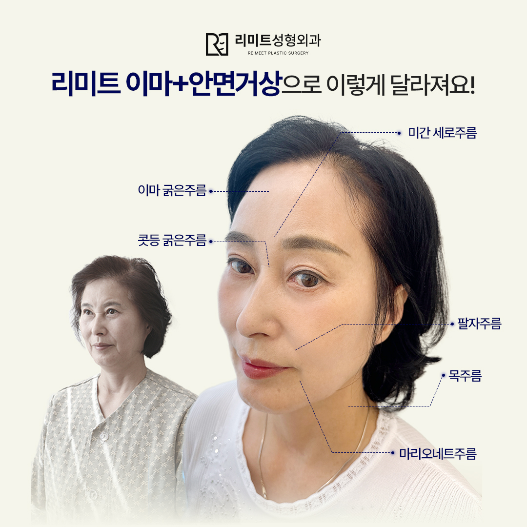 리미트성형외과의원