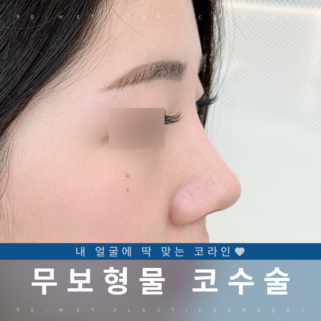 리미트성형외과의원 대표 이미지