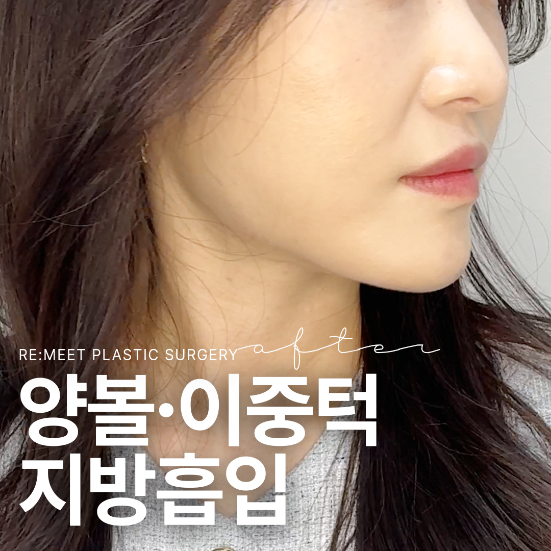 리미트성형외과의원
