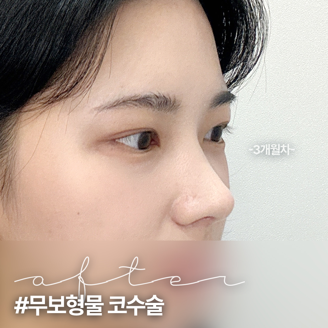 리미트성형외과의원 대표 이미지