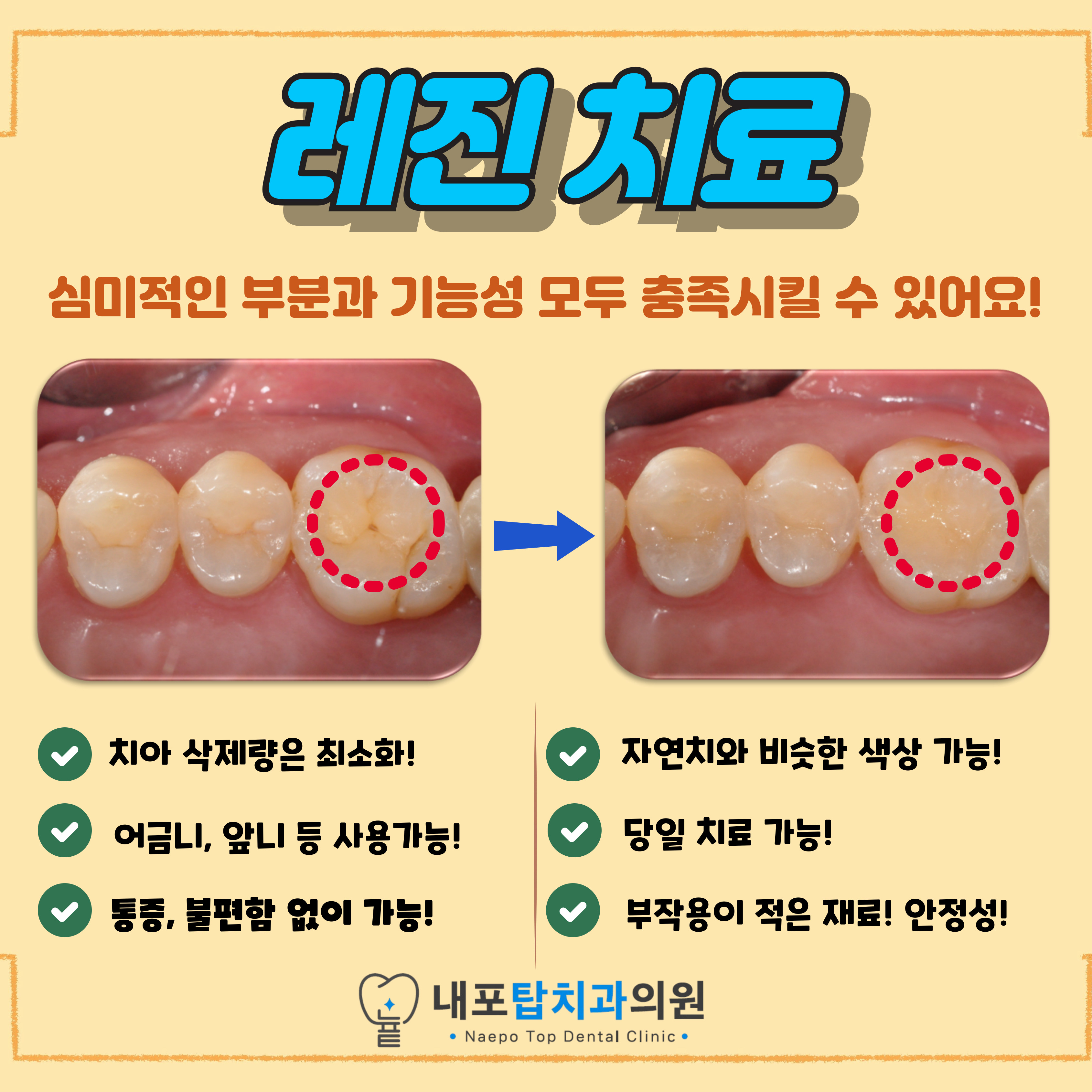 내포탑치과의원 대표 이미지