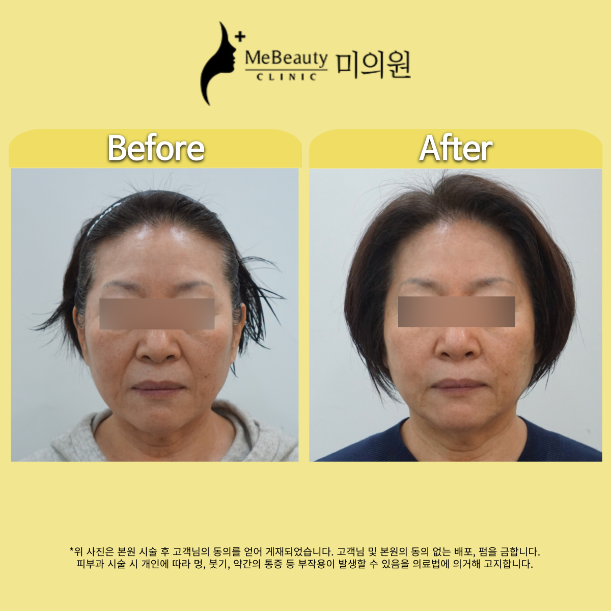 미의원