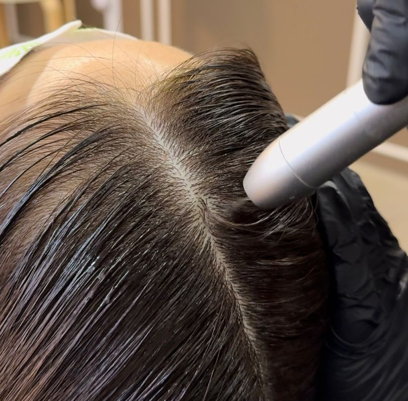 현스칼프 이대점 대표 이미지