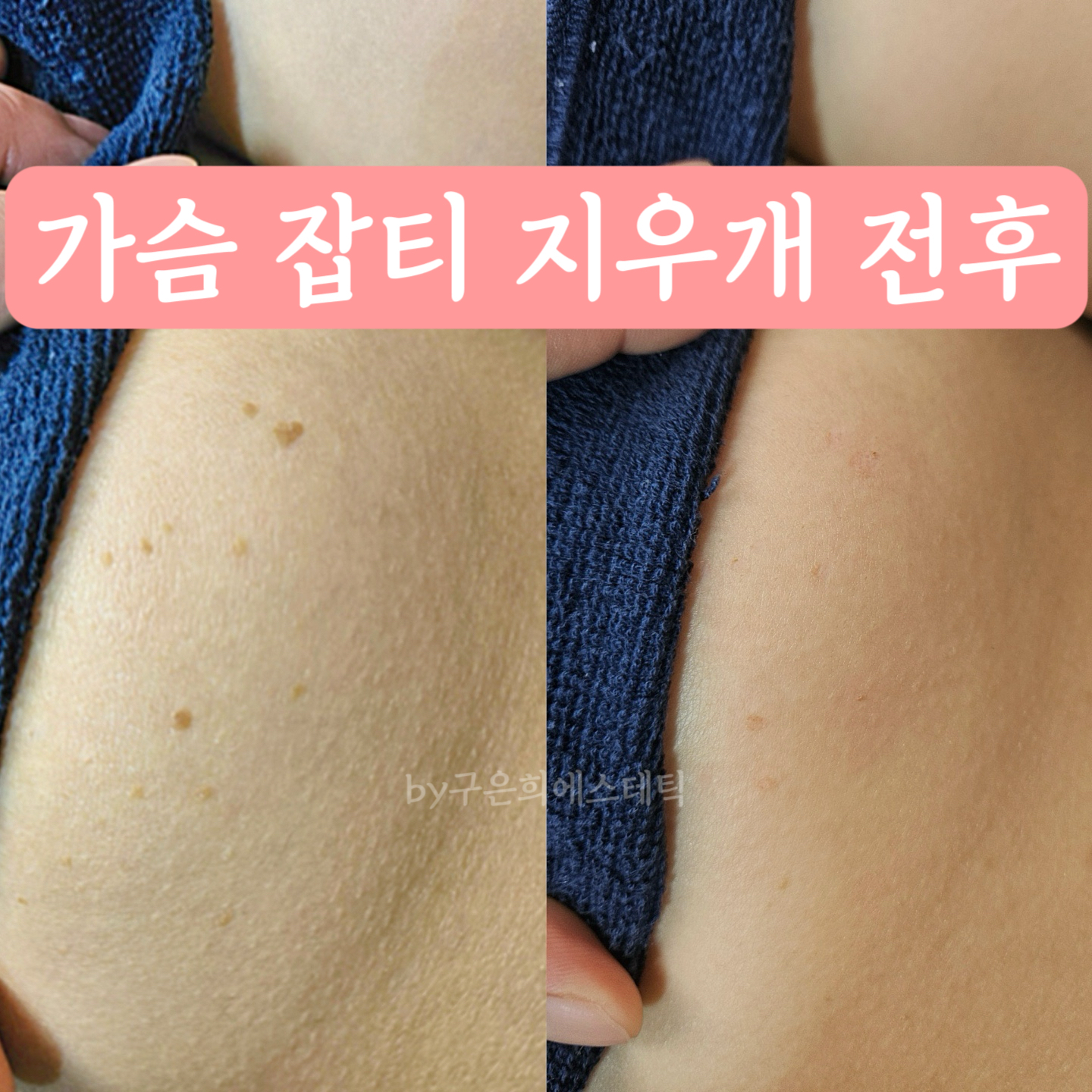 구은희에스테틱 대표 이미지