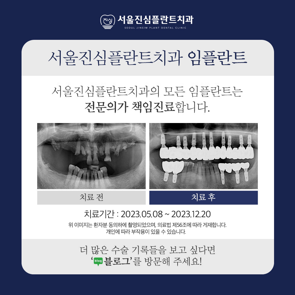 서울진심플란트치과의원