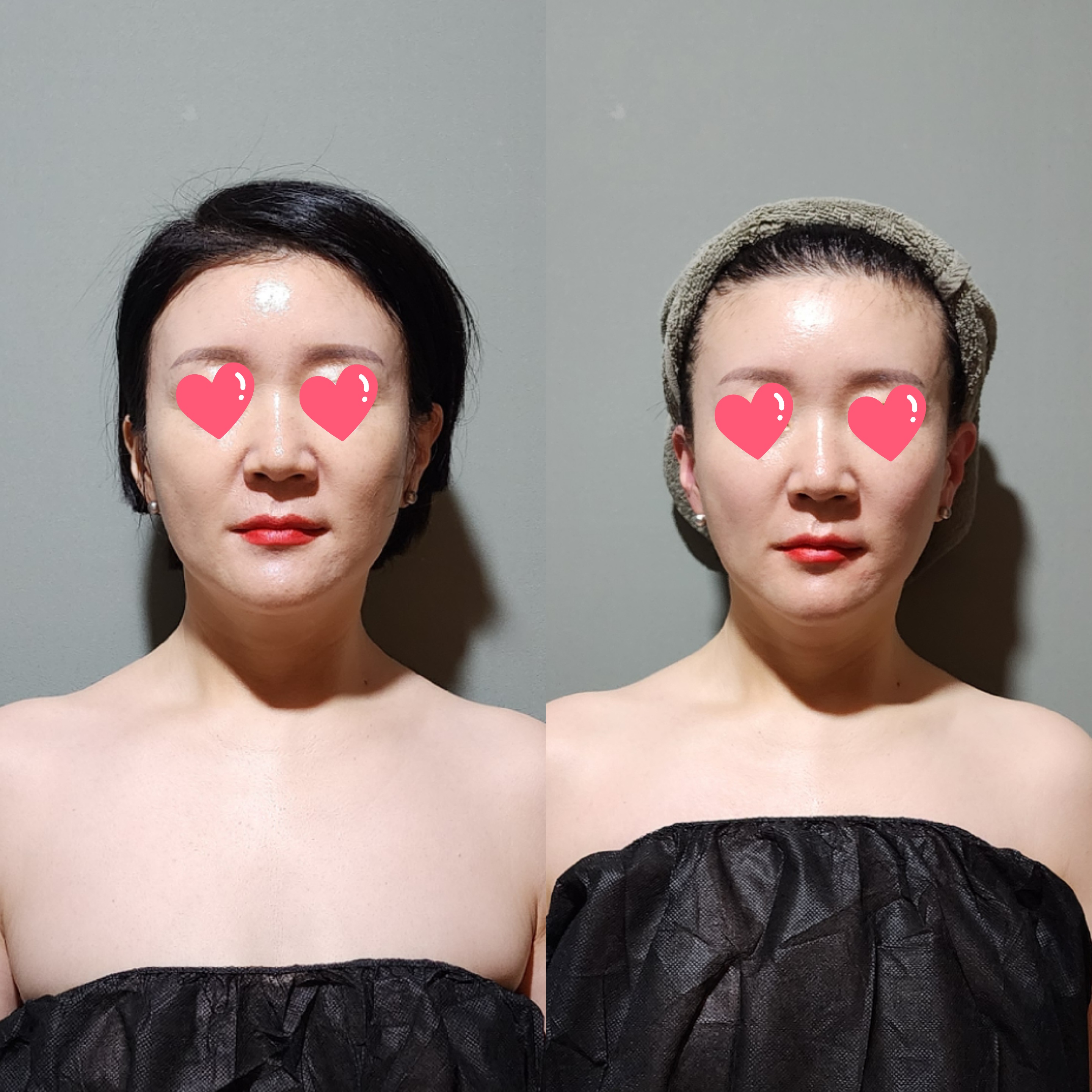 바른뷰티 photo 8