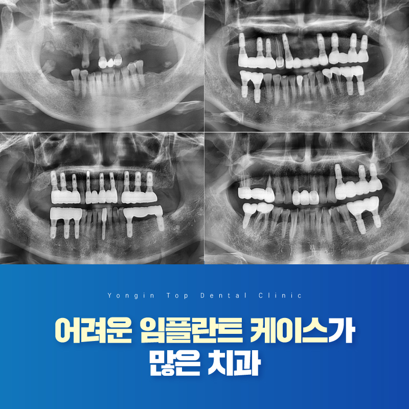 용인탑치과의원
