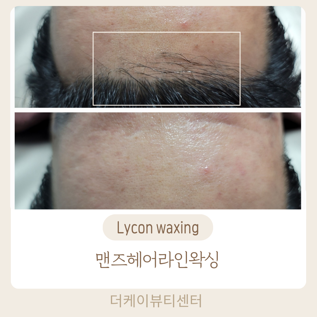 더케이 뷰티센터 포항본점