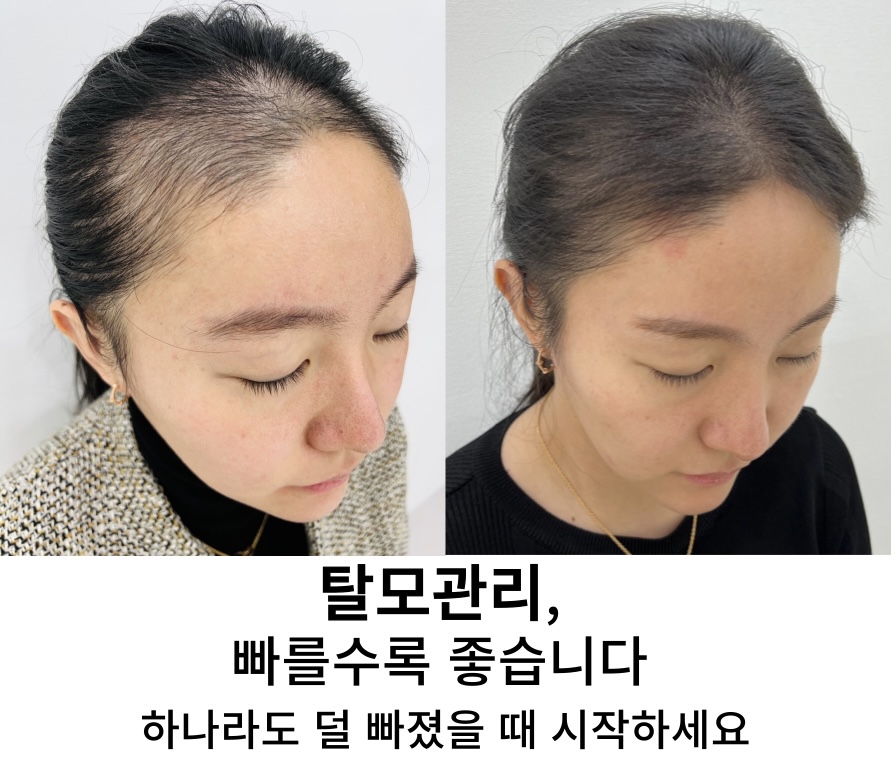모리셋두피재생센터 당진점 대표 이미지