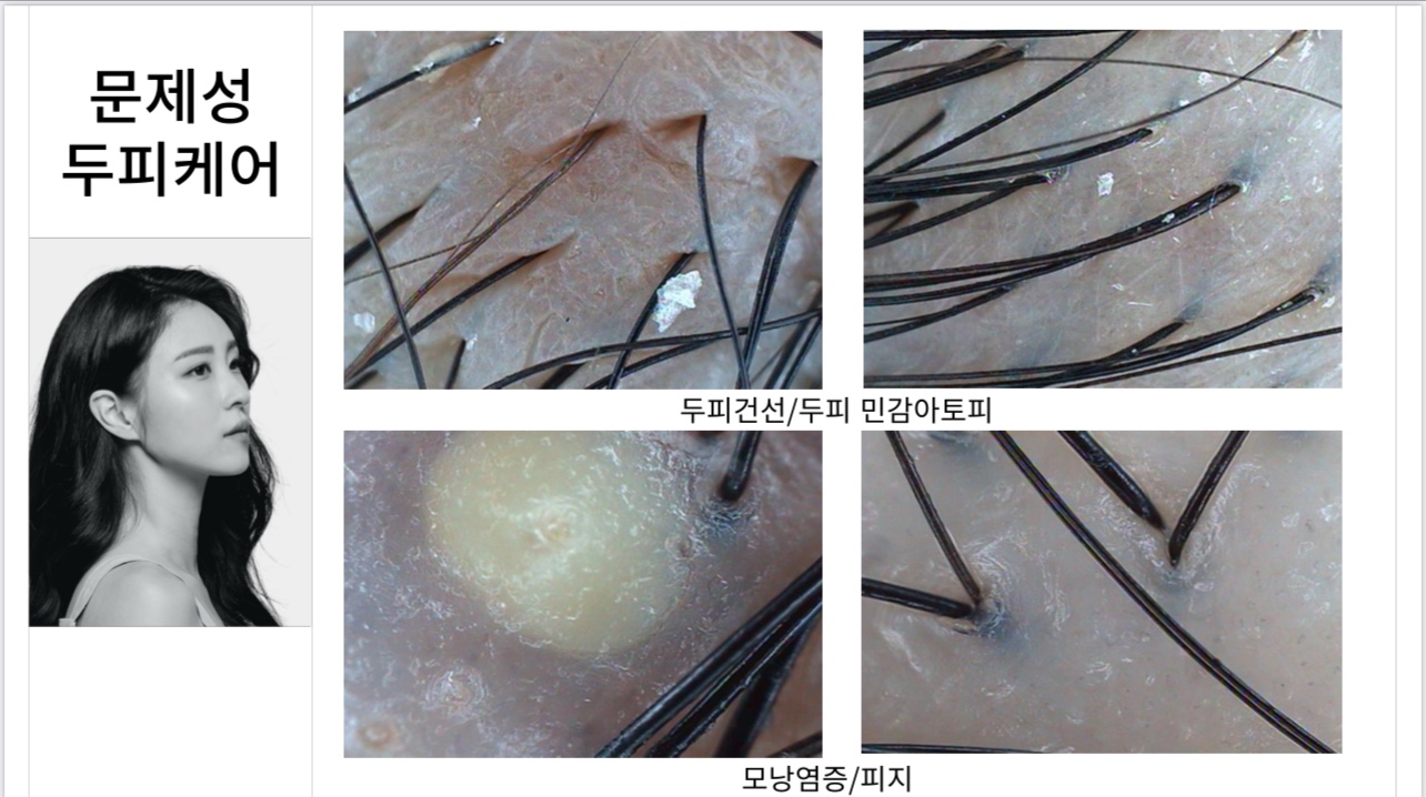 모리셋두피재생센터 대표 이미지